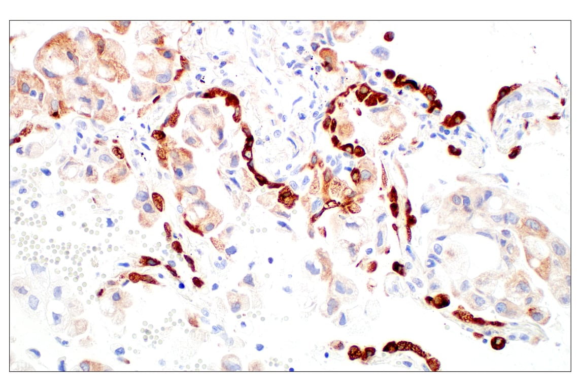 Immunohistochemistry Image 1: LPCAT1 (E4V4B) Rabbit Monoclonal Antibody (BSA and Azide Free)