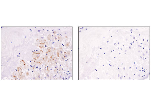 Immunohistochemistry Image 2: Prolactin Receptor (D4A9) Rabbit Monoclonal Antibody
