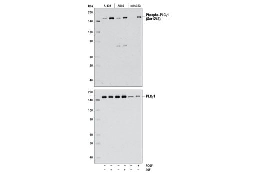 undefined Image 8: Angiogenesis Antibody Sampler Kit