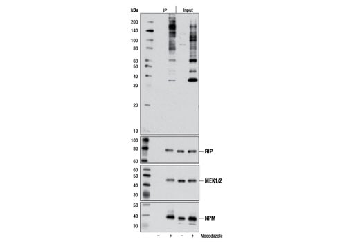 Immunoprecipitation Image 1: Phospho-PLK Binding Motif (ST*P) (D73F6) Rabbit Monoclonal Antibody