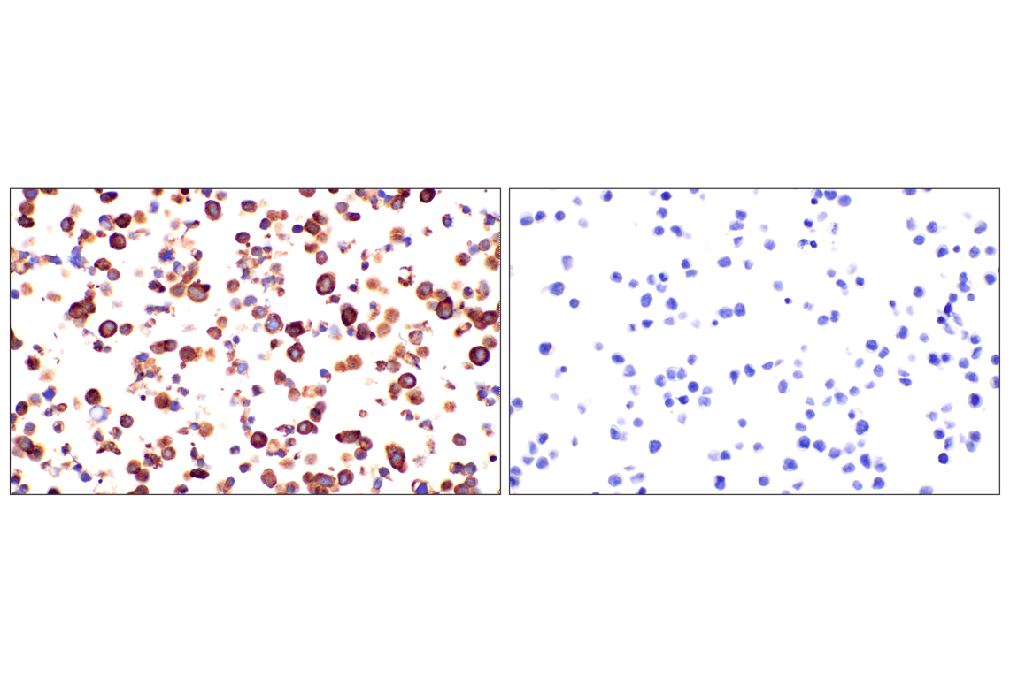 Immunohistochemistry Image 8: CHGA (F7D6H) Rabbit Monoclonal Antibody (BSA and Azide Free)