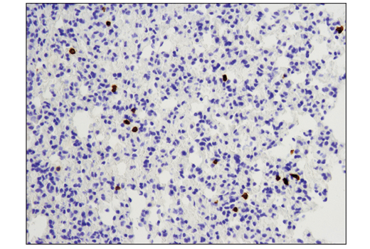 Immunohistochemistry Image 1: CD8 alpha (D4W2Z) Rabbit Monoclonal Antibody (BSA and Azide Free)