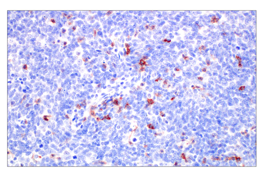 Immunohistochemistry Image 7: TIGIT (E5Y1W) Rabbit Monoclonal Antibody (BSA and Azide Free)