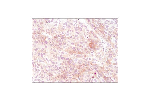 Immunohistochemistry Image 1: FGF Receptor 3 (C51F2) Rabbit Monoclonal Antibody (BSA and Azide Free)