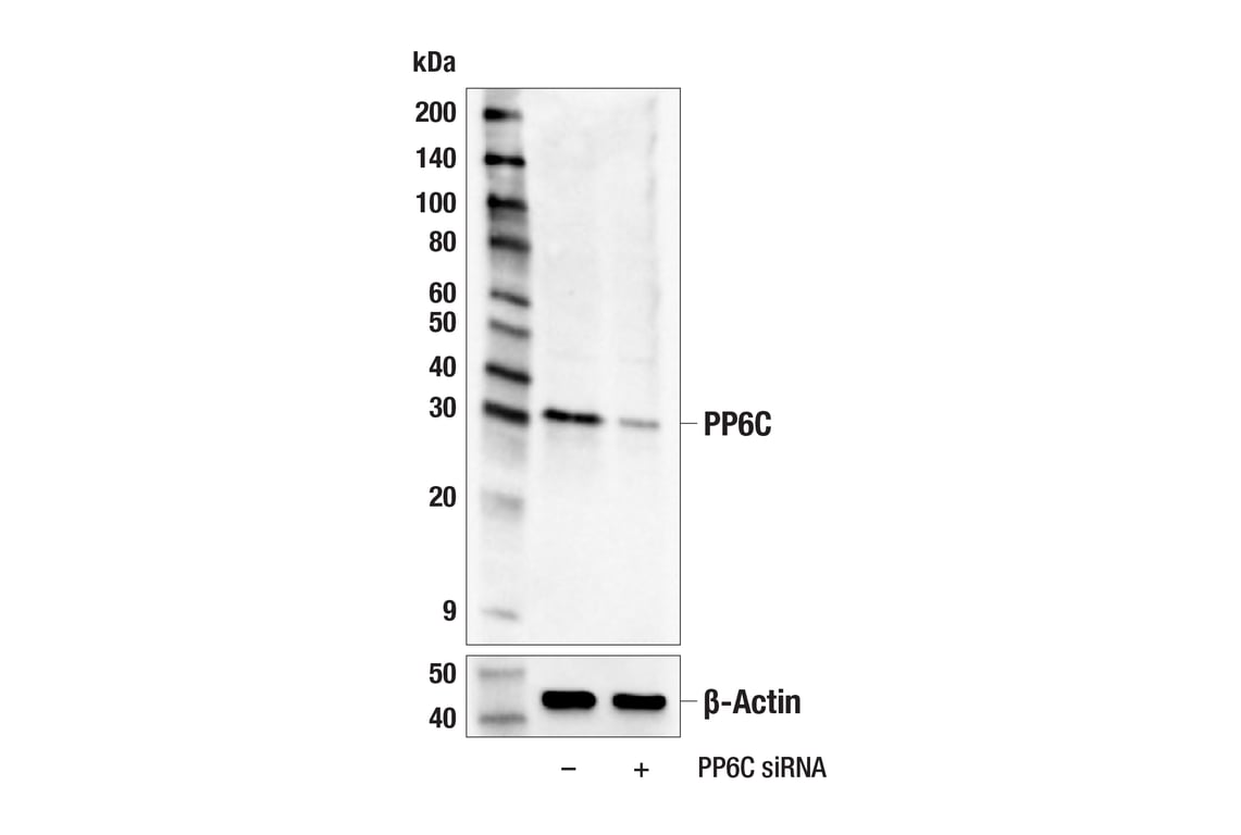 Western Blotting Image 3: PP6C (E3V2A) Rabbit Monoclonal Antibody