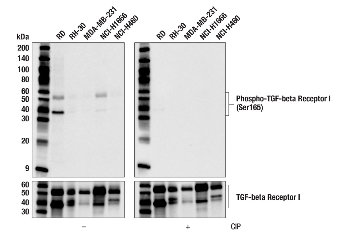 Western Blotting Image 1: Phospho-TGF-beta Receptor I (Ser165) (F5E2G) Rabbit Monoclonal Antibody