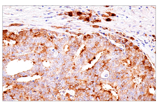 undefined Image 33: Genetics of Parkinson's Disease: Lysosomal Dysfunction Antibody Sampler Kit
