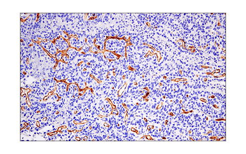 Immunohistochemistry Image 1: CD200 (E5I9V) Rabbit Monoclonal Antibody (BSA and Azide Free)