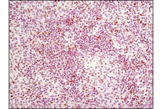 Immunohistochemistry Image 2: Bmi1 (D20B7) Rabbit Monoclonal Antibody