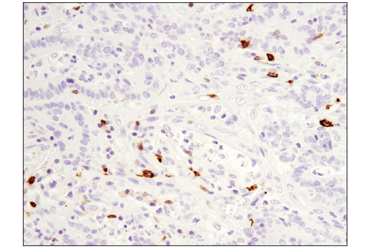 Immunohistochemistry Image 2: OX40 (E9U7O) XP<sup>®</sup> Rabbit mAb