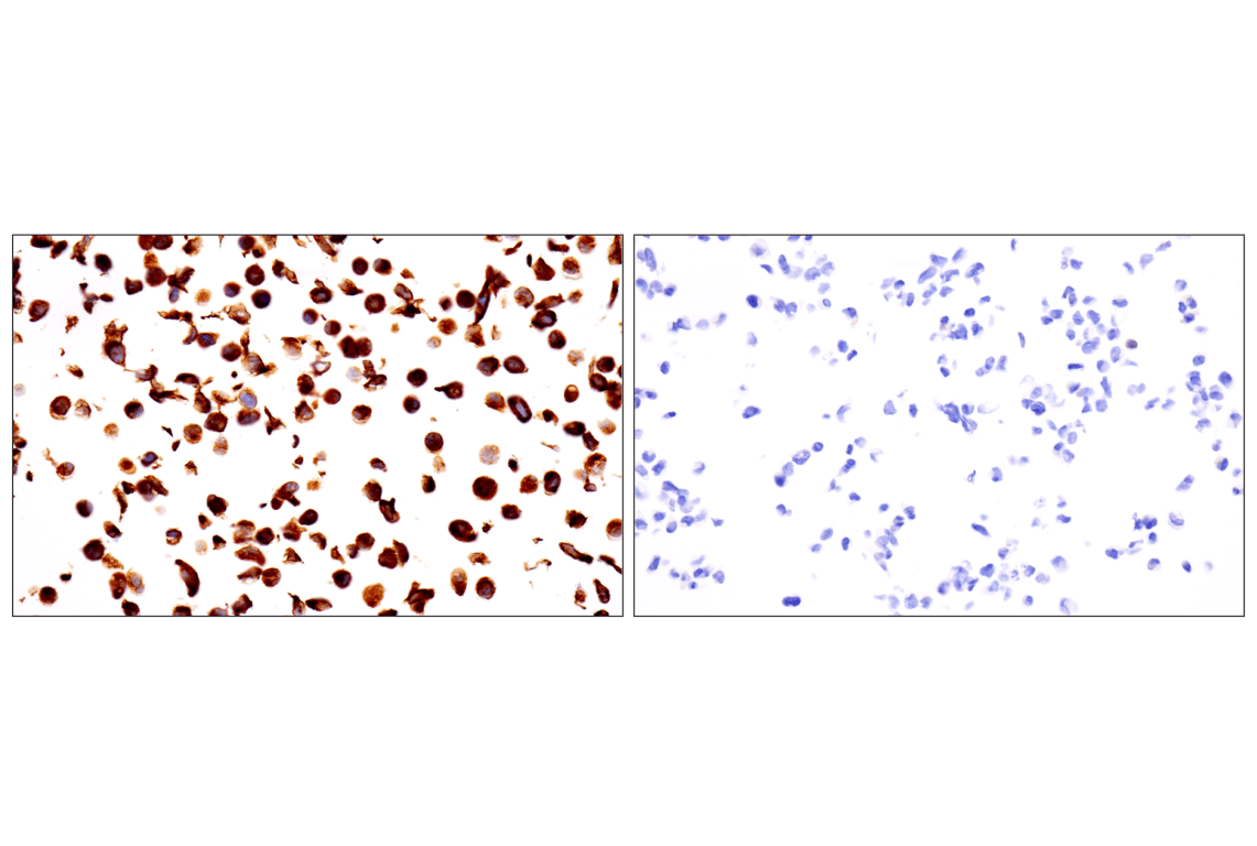 Immunohistochemistry Image 17: Desmin (F5V4I) Rabbit Monoclonal Antibody