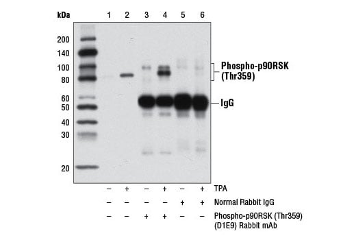 undefined Image 7: p90RSK Antibody Sampler Kit