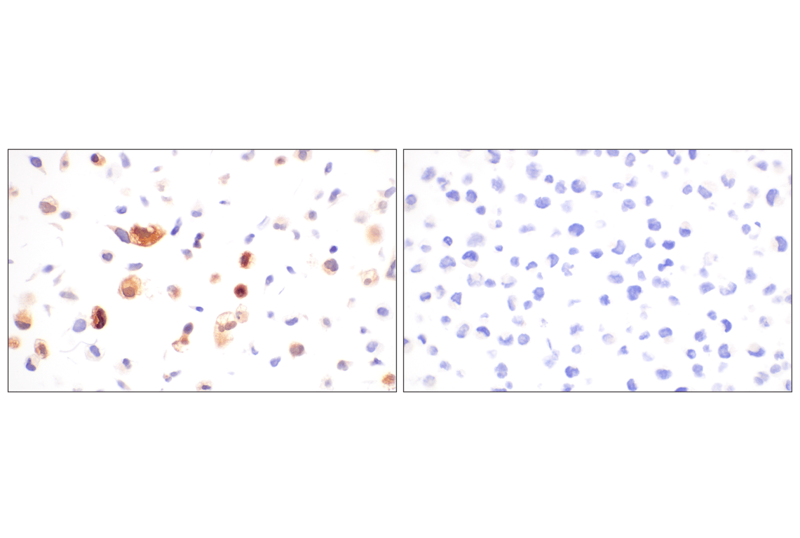 Immunohistochemistry Image 7: cPLA2 (D11H4) Rabbit Monoclonal Antibody