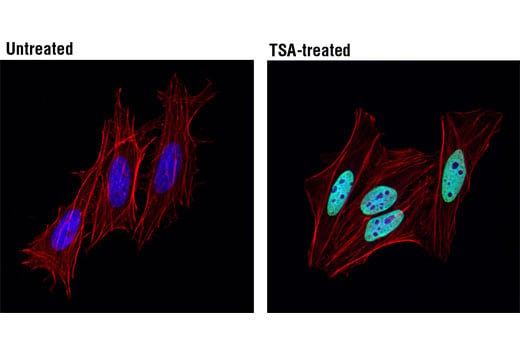 Immunofluorescence Image 1: Acetyl-Histone H2B (Lys5) (D5H1S) XP<sup>®</sup> Rabbit mAb (BSA and Azide Free)
