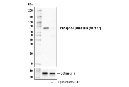 Western Blotting Image 3: Phospho-Optineurin (Ser177) (E8L9I) Rabbit Monoclonal Antibody