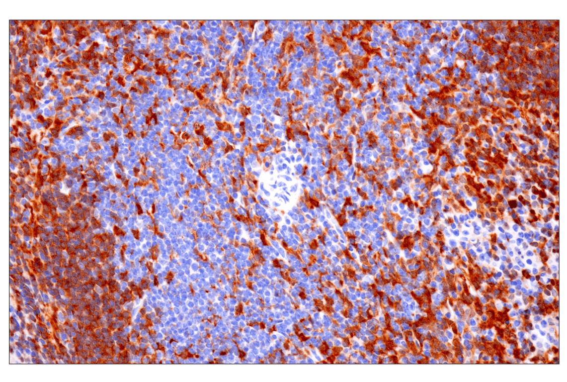 Immunohistochemistry Image 6: p47phox (F3Y6C) Rabbit Monoclonal Antibody (BSA and Azide Free)