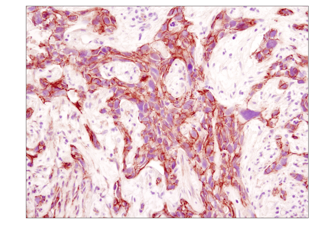 Immunohistochemistry Image 3: beta-Catenin (D10A8) Rabbit Monoclonal Antibody (BSA and Azide Free)
