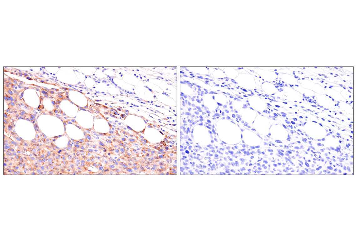 Immunohistochemistry Image 7: Axl (E3Z2H) Rabbit Monoclonal Antibody (BSA and Azide Free)