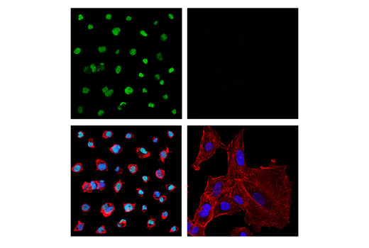 Immunofluorescence Image 1: LMO2 (E8K6I) Rabbit Monoclonal Antibody
