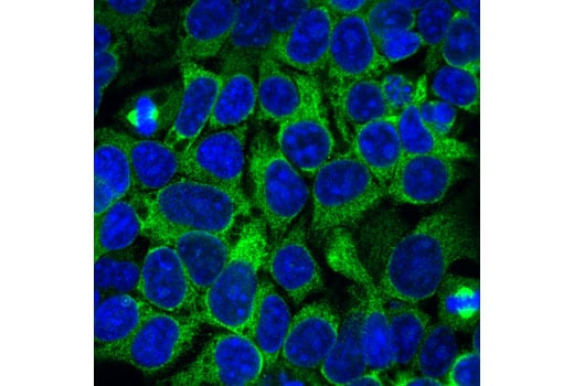 Immunofluorescence Image 1: Eg5 (E1L3W) Rabbit Monoclonal Antibody