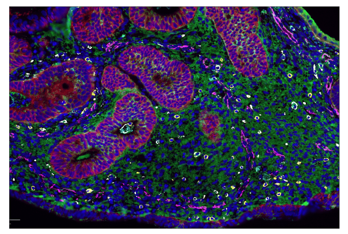 Immunohistochemistry Image 3: FGF Receptor 1 (D8E4) & CO-0156-488 SignalStar<sup>®</sup> Oligo-Antibody Pair