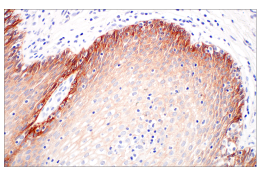 Immunohistochemistry Image 5: Integrin beta6 (E4M9P) Rabbit Monoclonal Antibody (BSA and Azide Free)