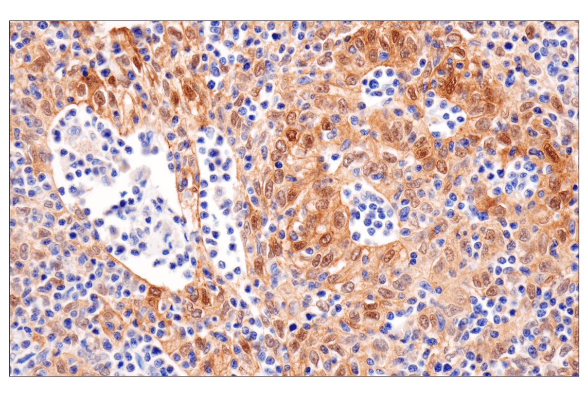 Immunohistochemistry Image 2: HSP27 (G31) Mouse Monoclonal Antibody