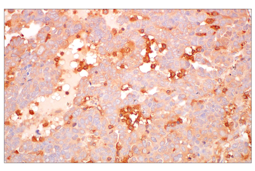 Immunohistochemistry Image 7: ILK1 (4G9) Rabbit Monoclonal Antibody (BSA and Azide Free)