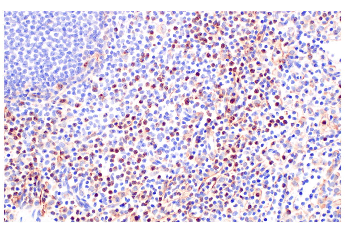 Immunohistochemistry Image 5: VISTA (D1L2G) Rabbit Monoclonal Antibody (BSA and Azide Free)