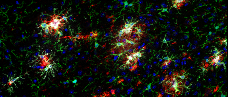 The new expanded portfolio of chimeric monoclonal antibodies features mouse, horse, and feline host species. Also available in affordable 20 μL trial sizes.