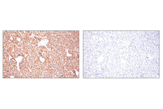 Immunohistochemistry Image 4: SHMT2 (E7F4Q) Rabbit Monoclonal Antibody