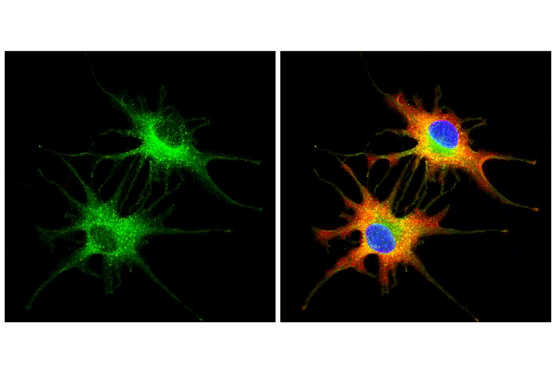 Immunofluorescence Image 1: Rab7 (E9O7E) Mouse Monoclonal Antibody (Alexa Fluor<sup>®</sup> 488 Conjugate)