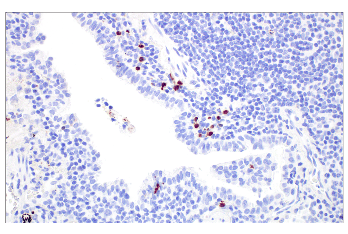 Immunohistochemistry Image 5: Cleaved Caspase-3 (Asp175) (D3E9) Rabbit Monoclonal Antibody (BSA and Azide Free)