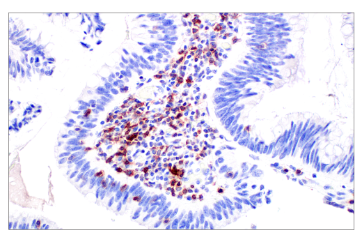 Immunohistochemistry Image 1: TIGIT (E5Y1W) Rabbit Monoclonal Antibody (BSA and Azide Free)