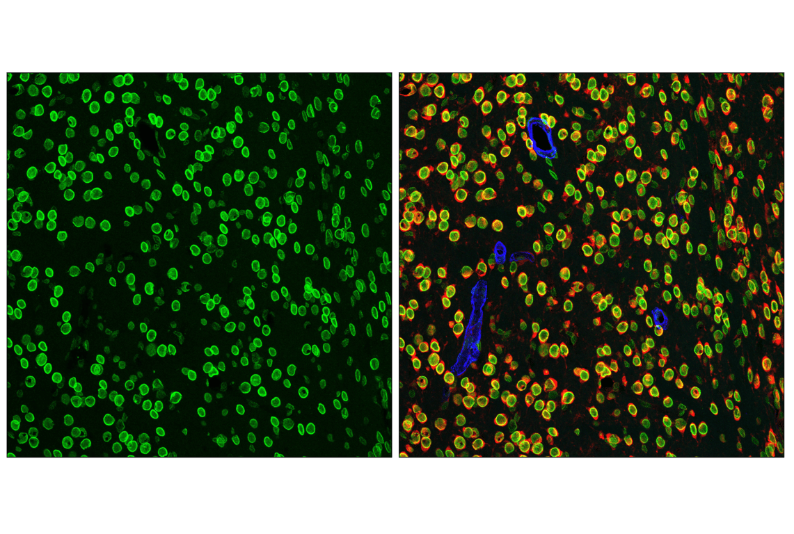 Immunofluorescence Image 3: NUP153 (E3N3Y) Rabbit Monoclonal Antibody