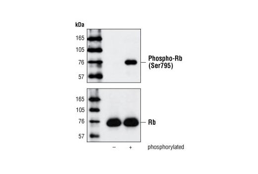 undefined Image 9: Rb Antibody Sampler Kit