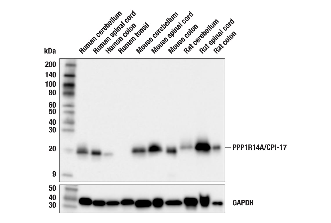 Western Blotting Image 2: PPP1R14A/CPI-17 (F4D8A) Rabbit Monoclonal Antibody