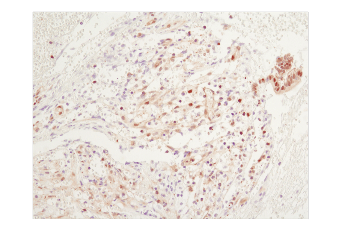 Immunohistochemistry Image 1: NF-κB p65 (D14E12) XP<sup>®</sup> Rabbit mAb (BSA and Azide Free)