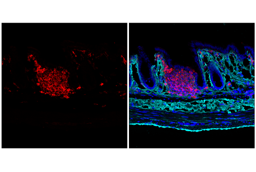 Immunofluorescence Image 3: SHIP1 (E8M5D) Rabbit Monoclonal Antibody