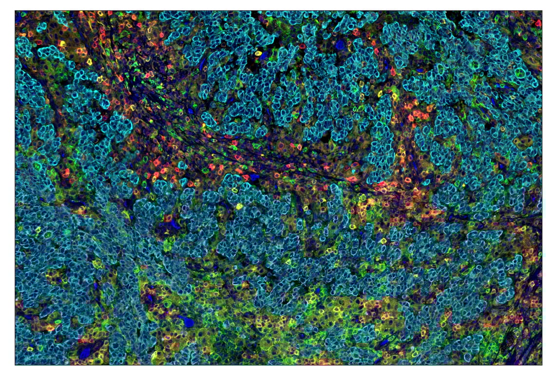 Immunohistochemistry Image 1: CD16 (D1N9L) & CO-0031-594 SignalStar<sup>™</sup> Oligo-Antibody Pair