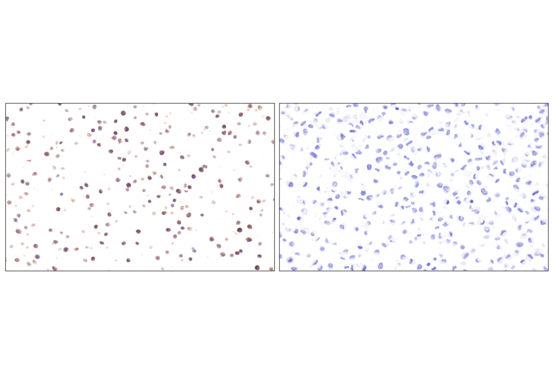 Immunohistochemistry Image 6: MHC Class II (I-E alpha) (F8N7J) Rabbit Monoclonal Antibody