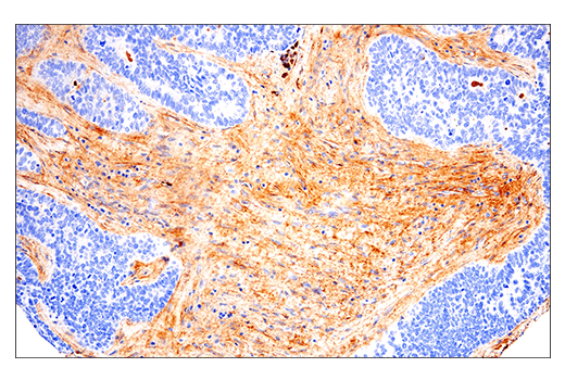 undefined Image 34: ECM Profiling Antibody Sampler Kit