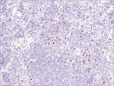 Immunohistochemical analysis of paraffin-embedded  spleen using FoxP3 (D6O8R) Rabbit mAb