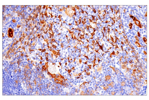 Immunohistochemistry Image 7: CRP2 (E8R5N) Rabbit Monoclonal Antibody