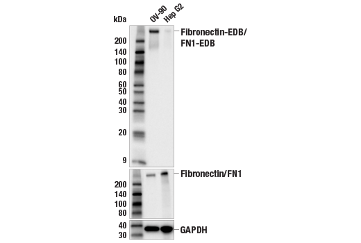 Western Blotting Image 2: Fibronectin-EDB/FN1-EDB (E8J3Z) Rabbit Monoclonal Antibody
