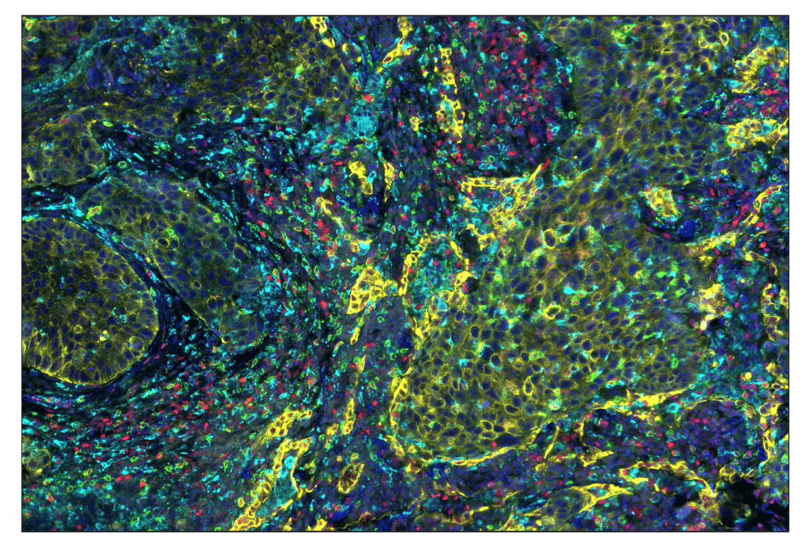 Immunohistochemistry Image 1: Anti-rabbit IgG & CO-0055-647 SignalStar<sup>®</sup> Secondary Antibody Kit