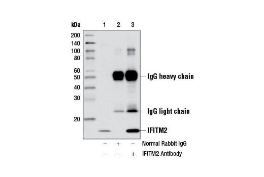 Immunoprecipitation Image 1: IFITM2 Antibody