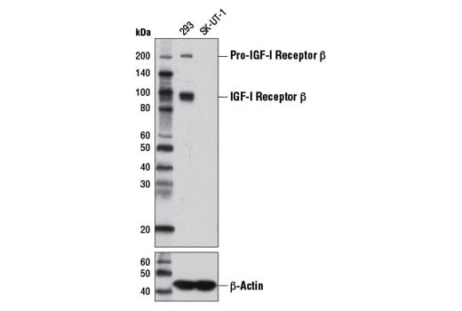 undefined Image 2: PhosphoPlus<sup>®</sup> IGF-I Receptor β Antibody Duet