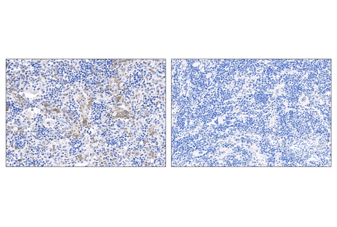 Immunohistochemistry Image 2: Whitlow/218 Linker (F2G3S) Rabbit Monoclonal Antibody