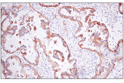Immunohistochemistry Image 1: CD151 (E4I9J) Rabbit Monoclonal Antibody